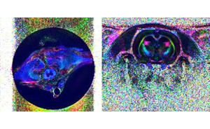 Diffusion MRI