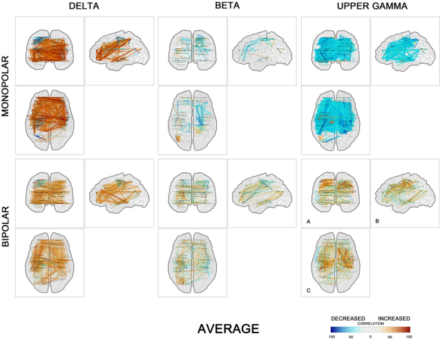 Deep brain activity research 